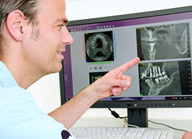 Knochenaufbau Knochenaufbau