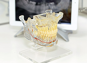 Weisheitszahnentfernung Weisheitszahnentfernung